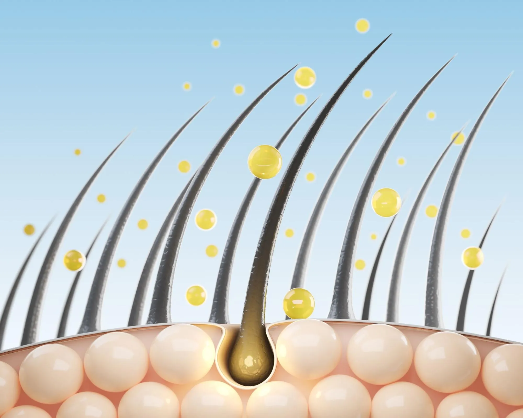 AGA治療（男性型脱毛症）